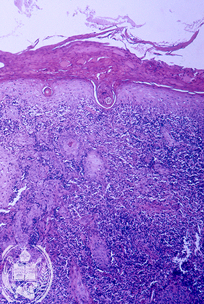 Fig. 11-A2
