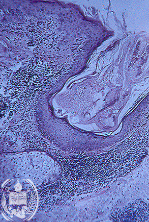 Fig. 7-B2