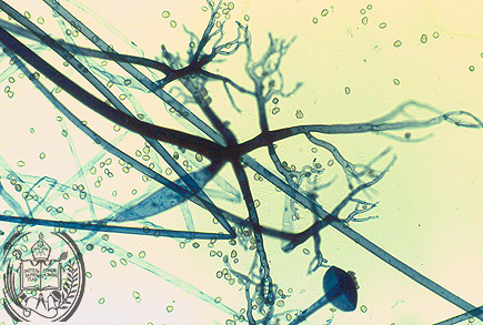 Fig. 63-A4