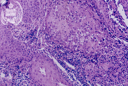 Fig. 64-B2