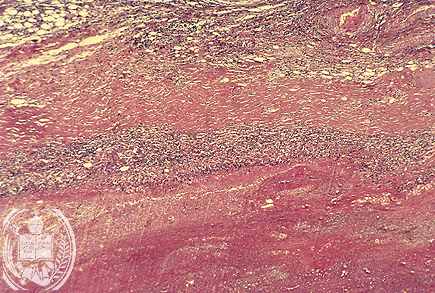 Fig. 13-A3
