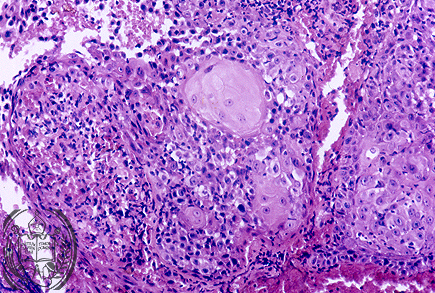 Fig. 13-B2