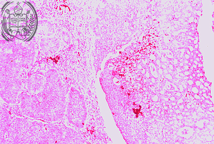 Fig. 14-B2