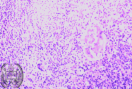 Fig. 16-B2