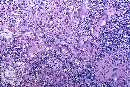 Fig. 17-A2