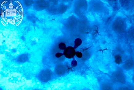 Fig. 17-A3