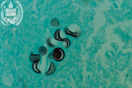 Fig. 21-A4