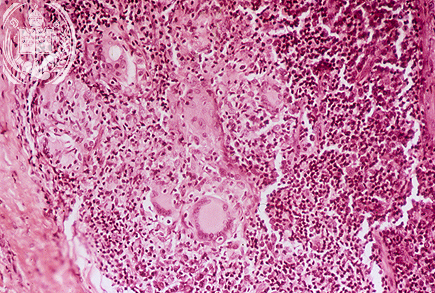 Fig. 44-A2